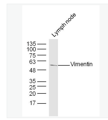 Anti-Vimentin antibody- 波形蛋白抗体