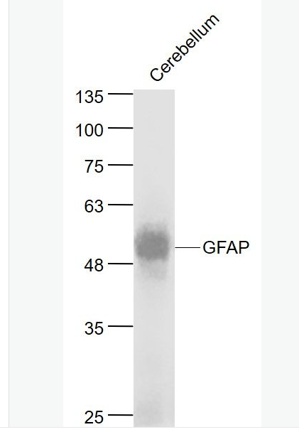 Anti-GFAP antibody- 胶质纤维酸性蛋白单克隆抗体