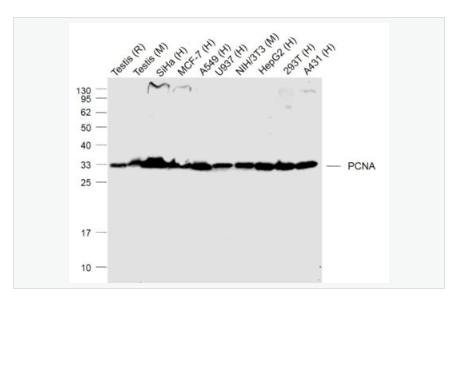 Anti-PCNA - 增殖细胞核抗原（核内参）重组兔单克隆抗体