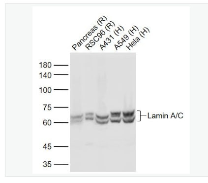 Anti-Lamin A/C antibody- 核纤层蛋白A抗体