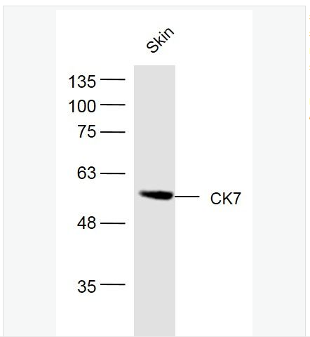 Anti-CK7 antibody- 细胞角蛋白7抗体