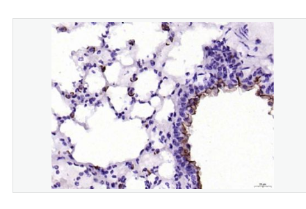 Anti-MUC1 antibody- 粘蛋白-1抗体