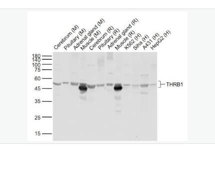 Anti-THRB1 antibody- 甲状腺激素受体β抗体