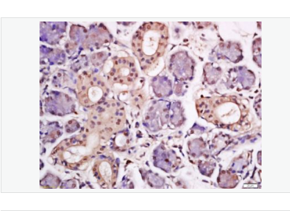 Anti-HPV16 E7 antibody- 人类乳头状瘤病毒16-E7抗体