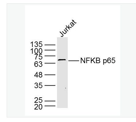 Anti-NFKB p65 antibody- 细胞核因子/k基因结合核因子单克隆抗体
