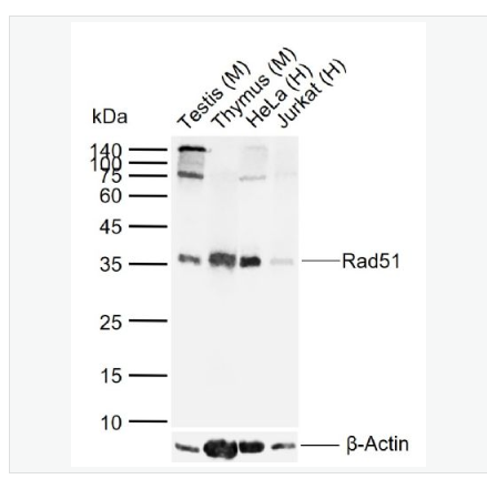 Anti-Rad51 antibody- Rad51重组兔单克隆抗体