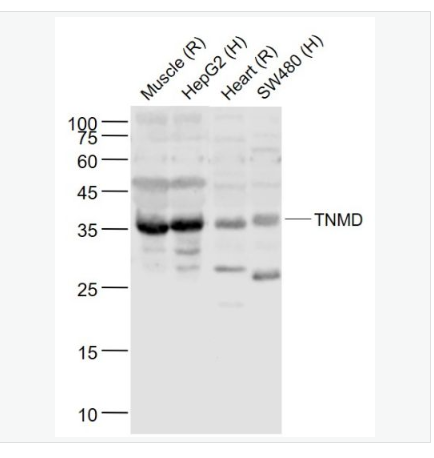 Anti-TNMD antibody- 腱调蛋白/软骨调节素样1蛋白抗体