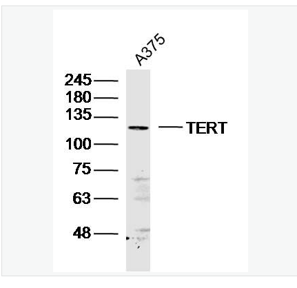 Anti-TERT antibody- 端粒酶反转录酶抗体