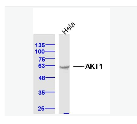 Anti-AKT1 antibody - 蛋白激酶B抗体