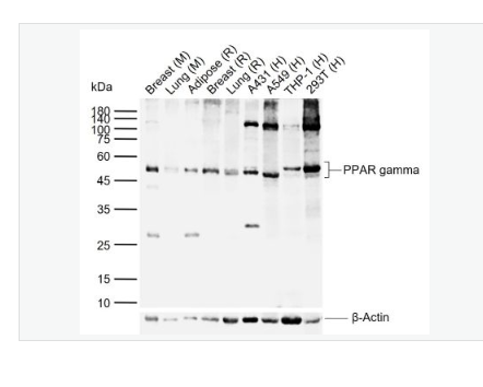 Anti-PPAR gamma antibody - 过氧化酶活化增生受体γ抗体