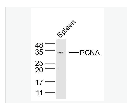 Anti-PCNA antibody- 增殖细胞核抗原抗体