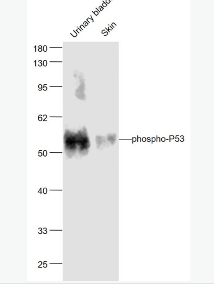 Anti-phospho-P53 - 磷酸化肿瘤抑制基因P53抗体