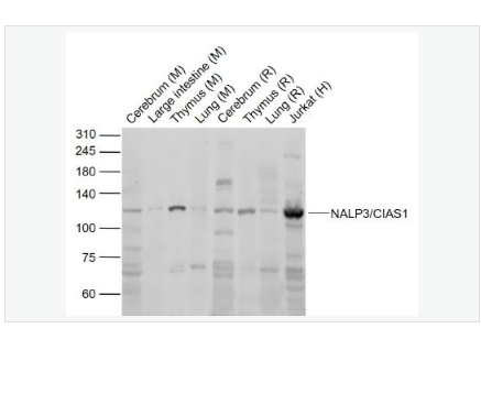 Anti-NALP3/CIAS1 antibody- 细胞凋亡诱导蛋白NALP3抗体