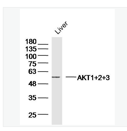 Anti-AKT1+2+3 antibody- 蛋白激酶AKT1,2,3抗体