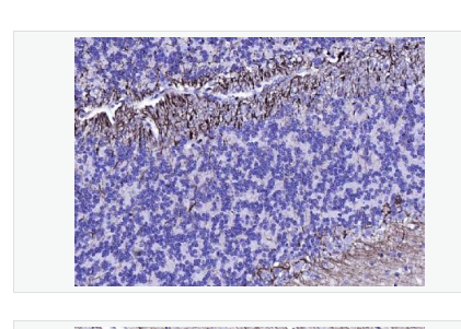 Anti-NF-L antibody- 低分子量神经丝蛋白单克隆抗体