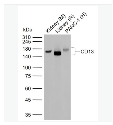 Anti-CD13 antibody- CD13重组兔单克隆抗体