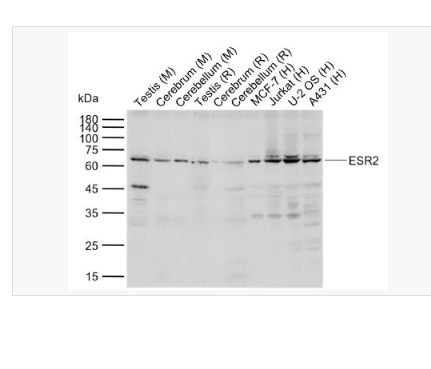 Anti-ESR2 antibody- 雌激素受体β抗体