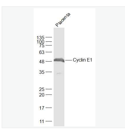 Anti-Cyclin E1 antibody-周期素E抗体