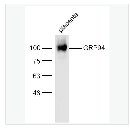 Anti-GRP94 antibody-葡萄糖调节蛋白94抗体