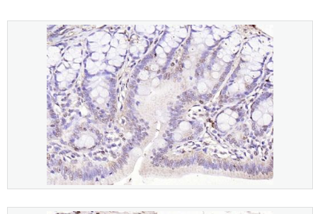 Anti-IL33 antibody-白介素33抗体