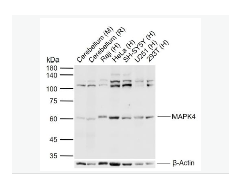 Anti-MAPK4 antibody-细胞外信号调节激酶4抗体