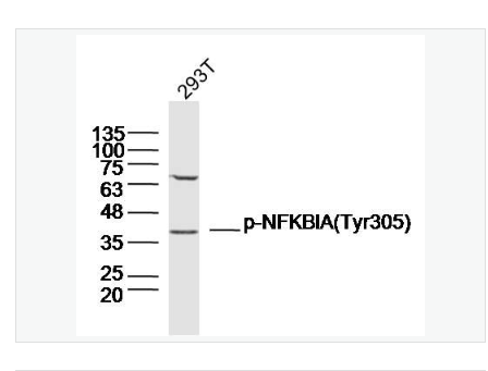 Anti- phospho-IKB alpha -磷酸化IKB alpha抗体