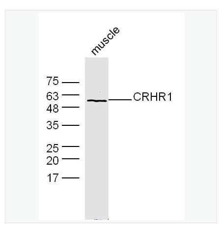 Anti-CRHR1 antibody -促肾上腺皮质释放激素受体1抗体
