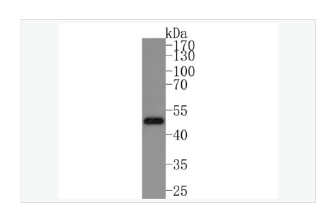 Anti-IKK gamma  antibody  -KB抑制蛋白激酶γ重组兔单克隆抗体