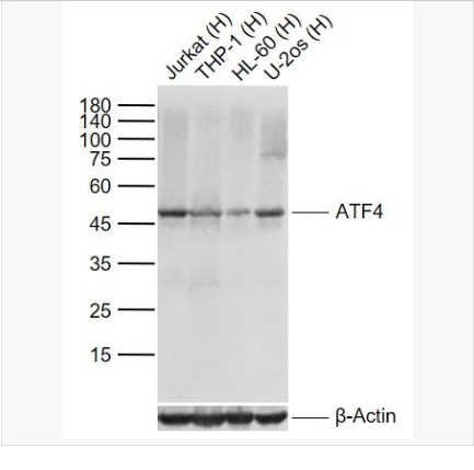 Anti-ATF4 antibody -活化转录因子4重组兔单克隆抗体