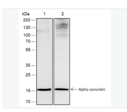 Anti-Alpha Synuclein antibody -核突触蛋白-α（N端）抗体