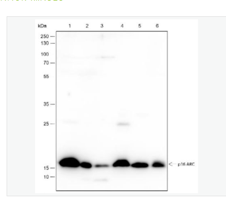 Anti-ARPC5 antibody -肌动蛋白相关蛋白2/3复合体亚基5重组兔单克隆抗体