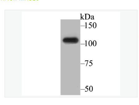 Anti-BRD2 antibody -BRD2蛋白重组兔单克隆抗体