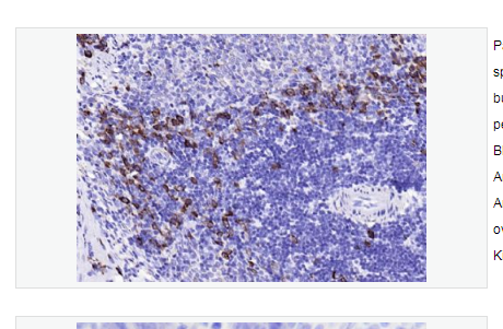 Anti-JCHAIN antibody -J-chain重组兔单克隆抗体