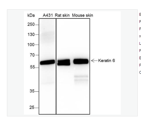 Anti-Keratin 6 antibody -细胞角蛋白6兔单克隆抗体