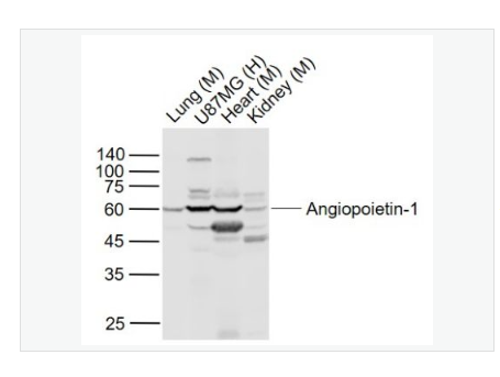 Anti-Angiopoietin-1 antibody -血管生成素-1抗体