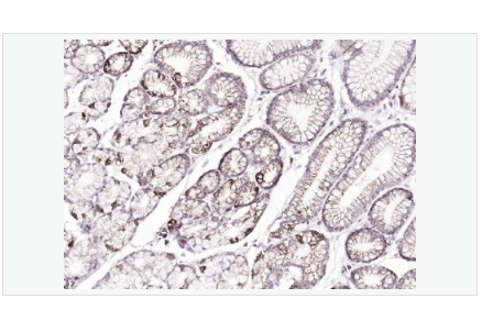 Anti-ATP7B antibody -铜转运蛋白质β链抗体