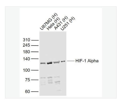 Anti-HIF-1 Alpha antibody -缺氧诱导因子1α /低氧诱导因子-1抗体