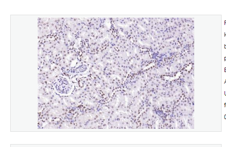 Anti-CENPA antibody-着丝粒蛋白A