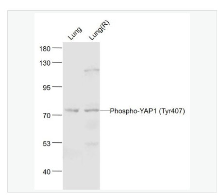 Anti-Phospho-YAP1-磷酸化原癌基因Yes相关蛋白1抗体