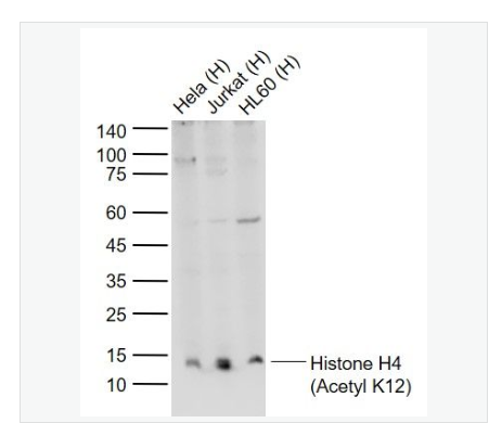 Anti-Histone H4 antibody -乙酰化组蛋白H4抗体