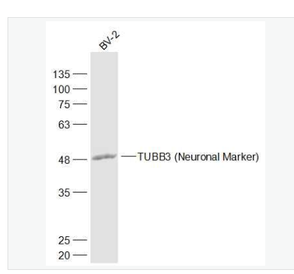 Anti-TUBB3 antibody-神经细胞特异性微管蛋白抗体