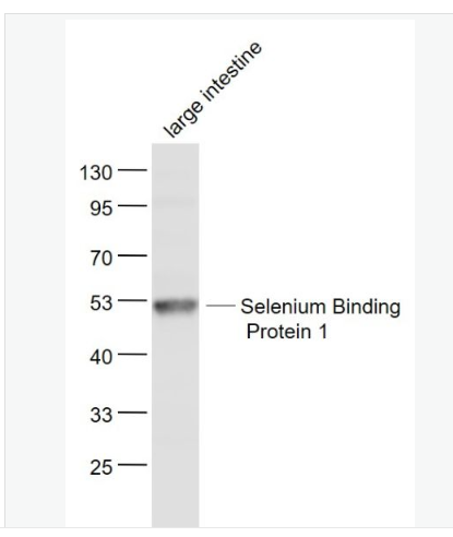 Anti-Selenium Binding Protein 1 antibody-硒结合蛋白1抗体