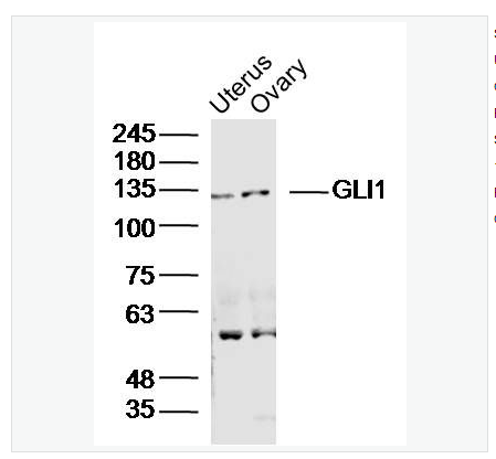 Anti-GLI1 antibody-脑胶质瘤相关蛋白抗体（锌指蛋白5）