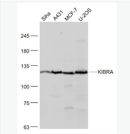 Anti-KIBRA antibody-肾脏和脑蛋白抗体