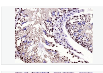 Anti-BPTF antibody-胎儿阿兹海默病抗原/核小体重塑因子抗体