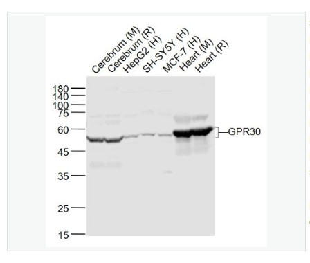 Anti-GPR30 antibody-G蛋白偶联受体30抗体