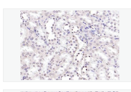 Anti-Beta catenin antibody-β-连环蛋白/β-连环素/β链接素单克隆抗体