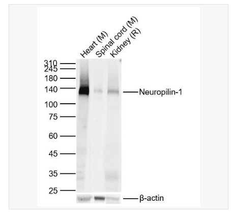 Anti-Neuropilin-1 antibody-神经纤毛蛋白1重组兔单克隆抗体