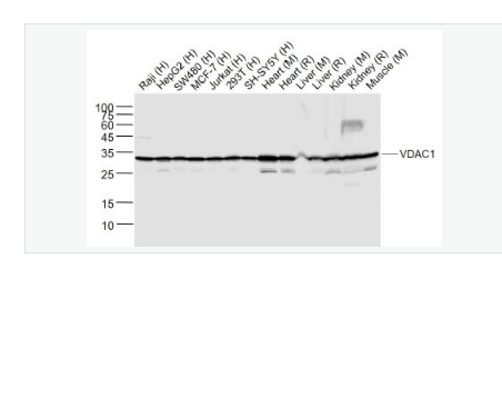 Anti-VDAC1-等电压依赖性阴离子通道（内参）重组兔单克隆抗体