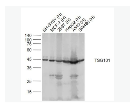 Anti-TSG101 antibody-肿瘤易感基因101蛋白抗体